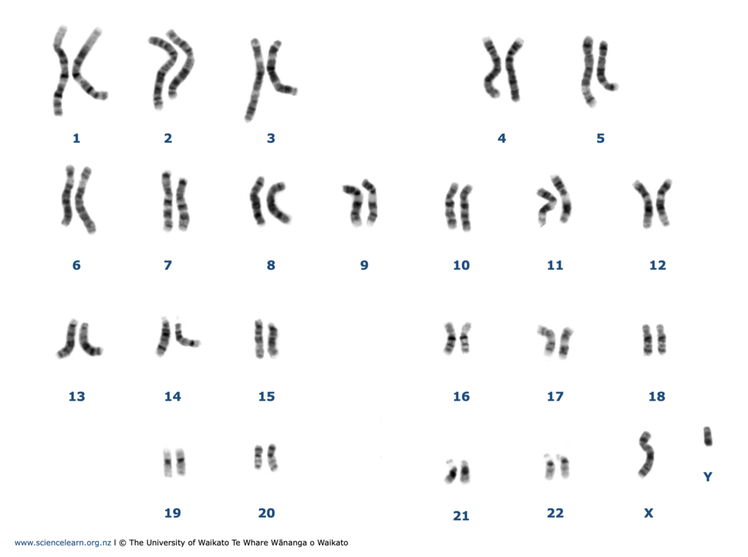 Karyotype of a human male.