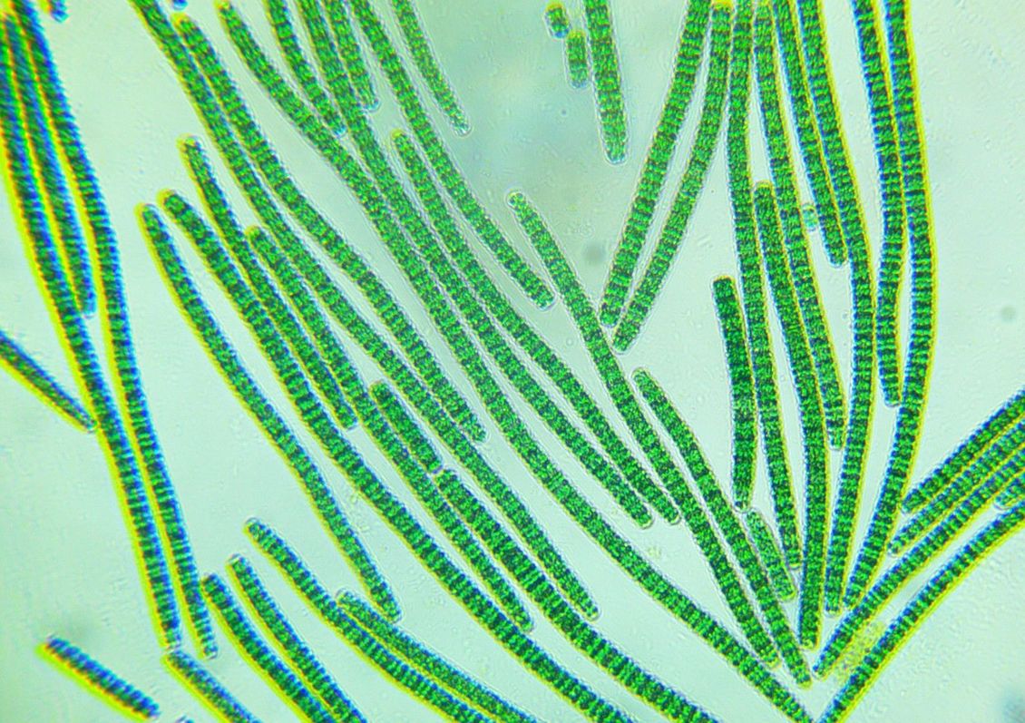 Spirulina Platensis Microscopy Sample under a microscope. 