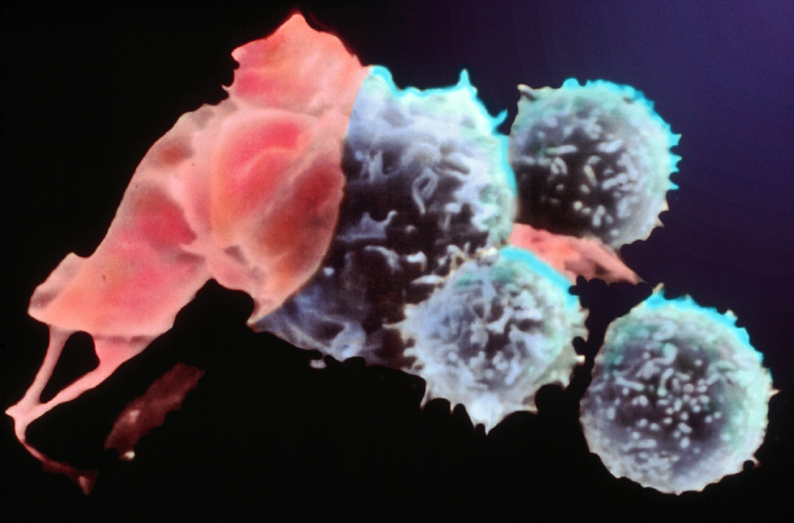 Image of Killer T cells (or cytotoxic T cells). 