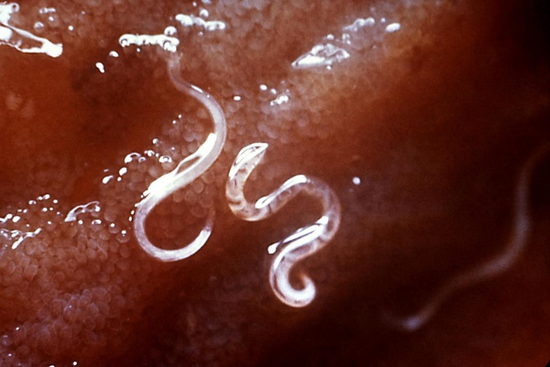 Ancylostoma caninum hookworms in a dog. 