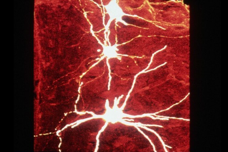Motor neurons in the spinal cord of a rat microscopic view.