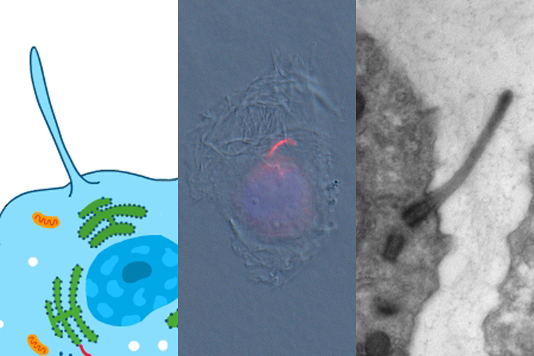 Primary cilium: diagram, microscope, view: optical and TEM