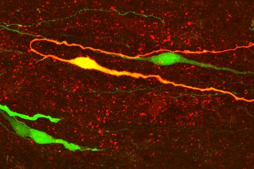 GnRH neurons (length of dendrite) in transgenic mice.
