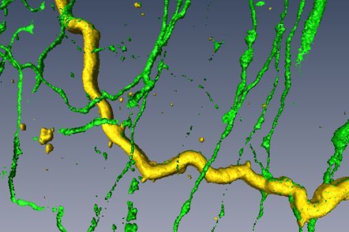 Confocal laser scanning microscopy of dendrite of a GnRH neuron