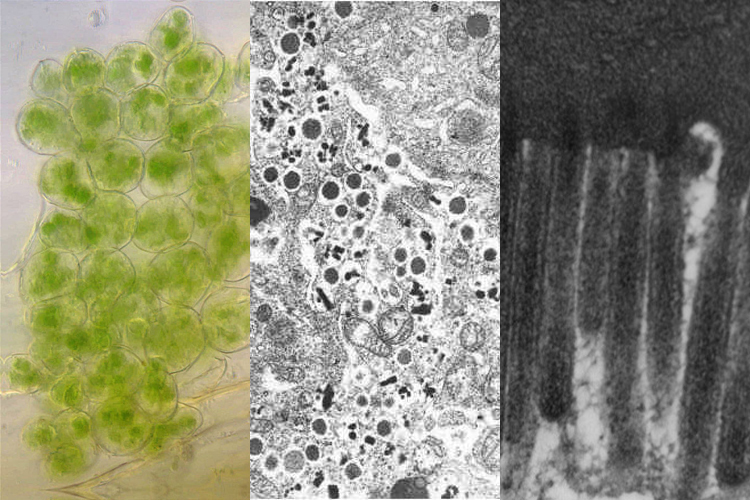 Chloroplasts (left) Storage granules (centre) Microvilli (right)