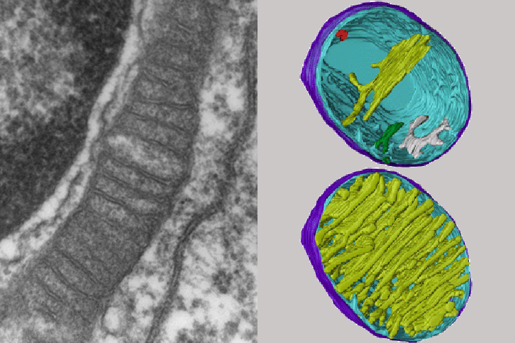 Mitochondria under electron microscopy and electron tomography. 