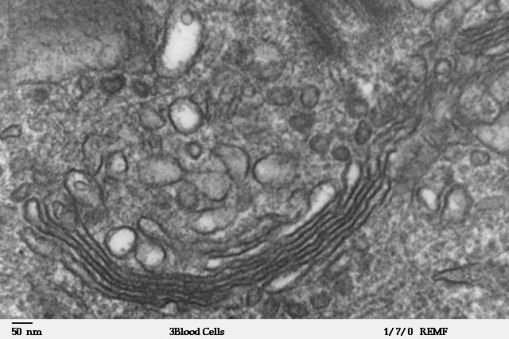 Transmission electron microscope image of a human leukocyte. 