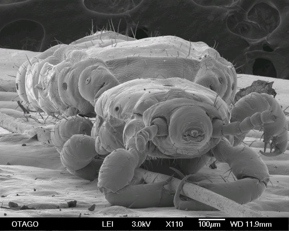 A head louse clasping a human hair under a SEM microscope.