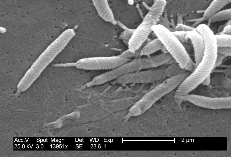 Microscopic view of Helicobacter bacteria.