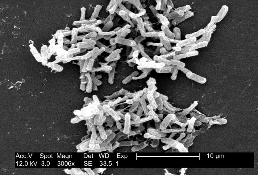 Microscopic view of Clostridium bacteria.