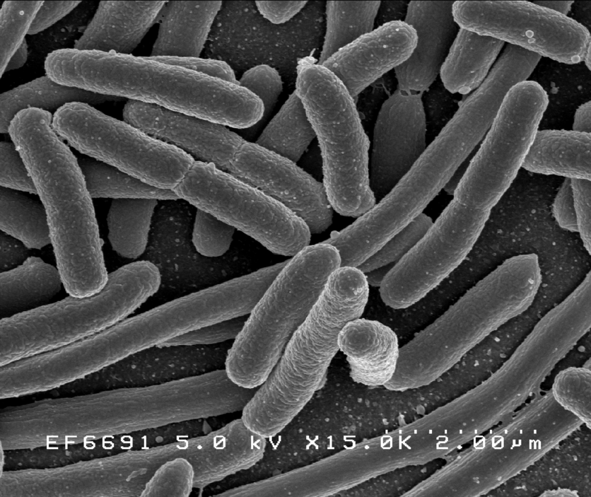 Microscopic image of Escherichia coli (E. coli).