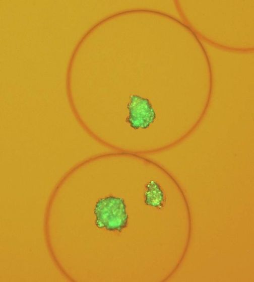 Microscope image of pig islet cells encapsulated in alginate