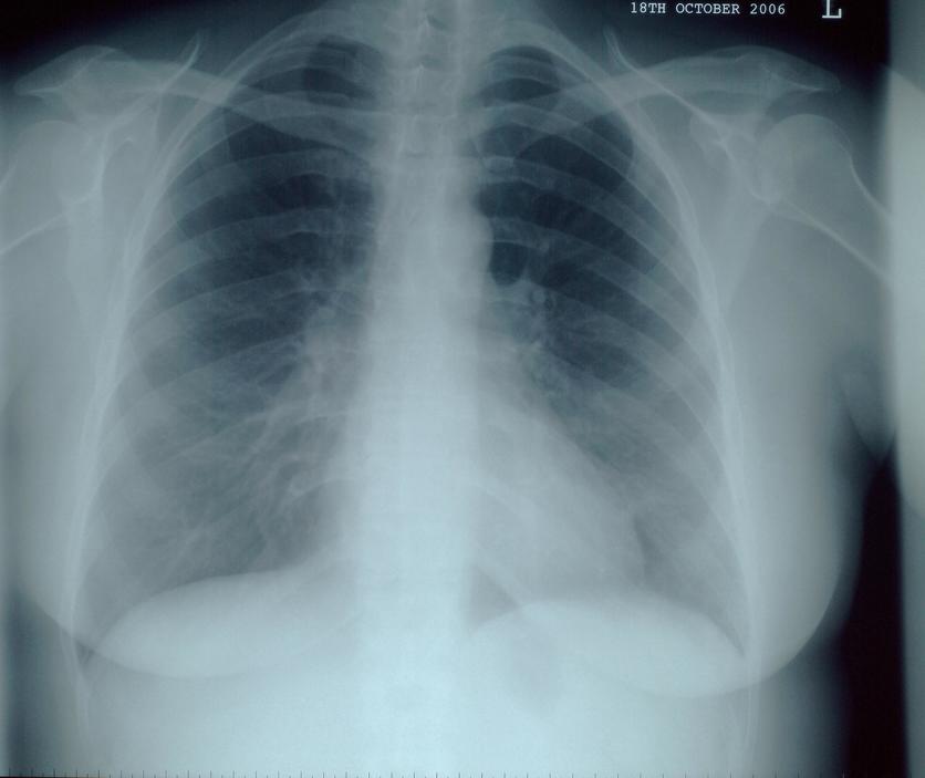 \u2014 Science X-ray Hub Learning imaging \u2014 X-ray imaging Hub Learning Science