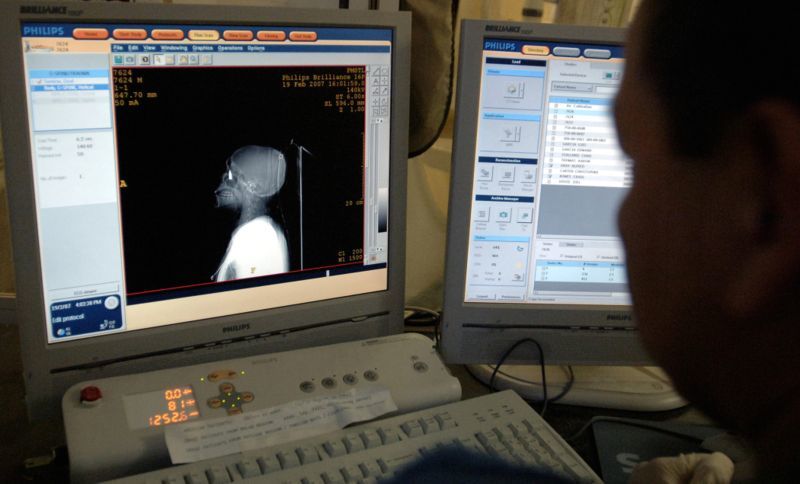 Medic looking at computer with a head and neck CT scan.