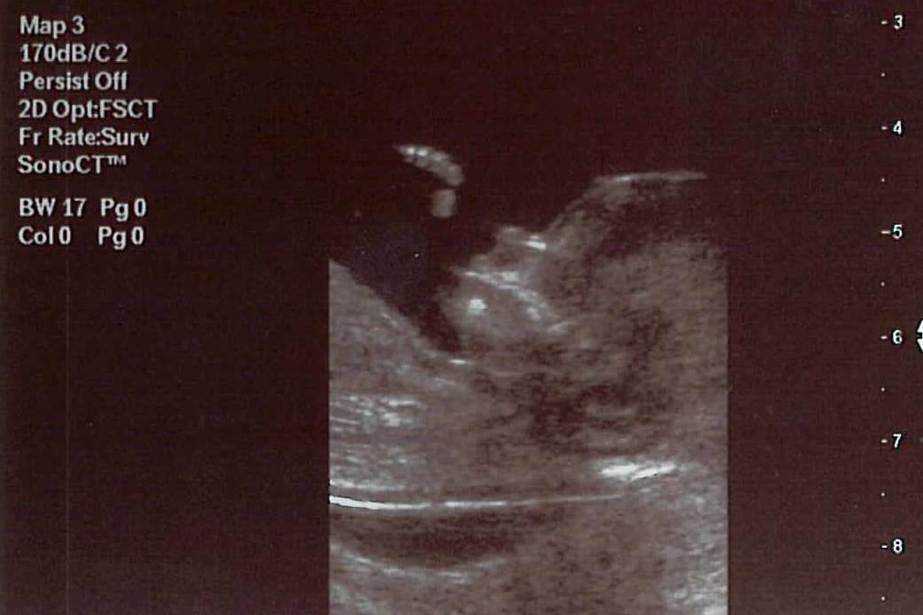 Ultrasound of an unborn baby