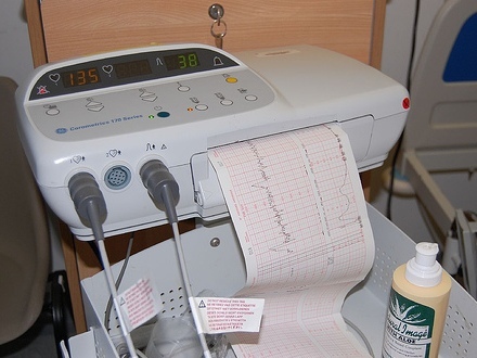 Electrocardiogram monitor machine at a hospital.