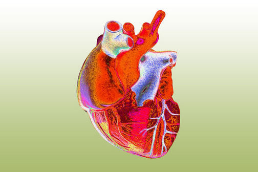 Enhanced image of a human heart.