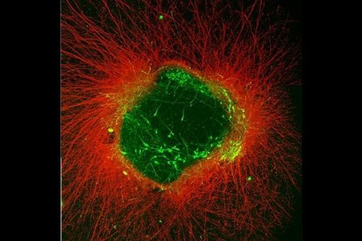 Basal forebrain axons & GnRH neurons after kisspeptin treatment