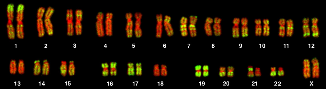 Human female metaphase chromosomes.
