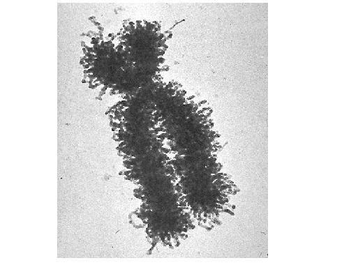Electron micrograph of a human chromosome. 