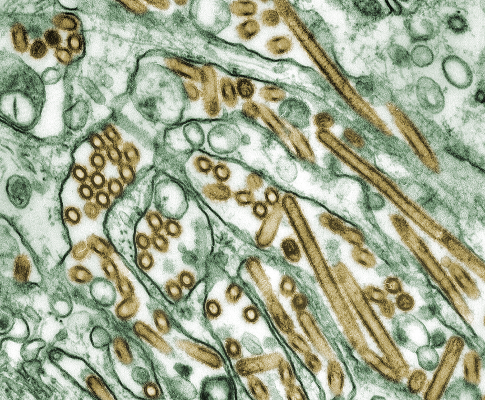 Colourised electron transmission micrograph of avian influenza.