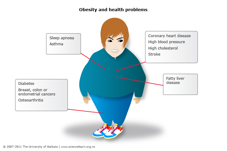 Obesity cartoon showing health problems associated with obesity.