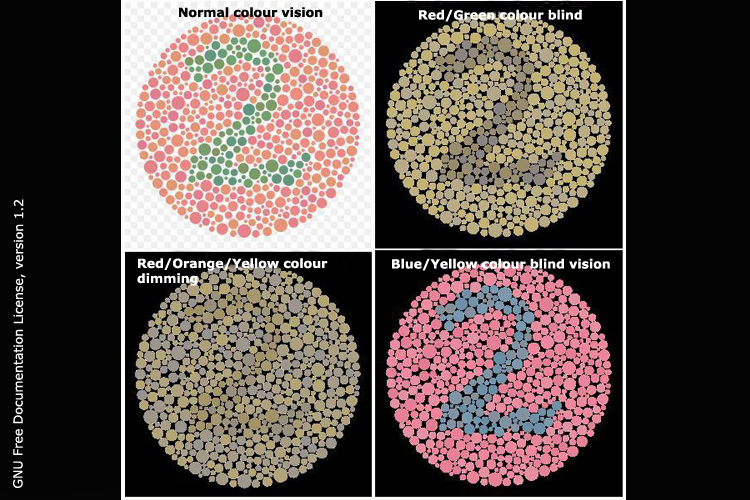 Ishihara test image seen by those with differing colour vision.