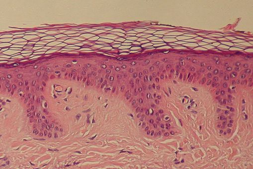 Skin: Normal Epidermis and Dermis with Intradermal Nevus