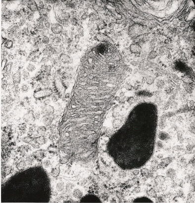 Electron micrograph micrograph: mitochrondrion inside a rat cell