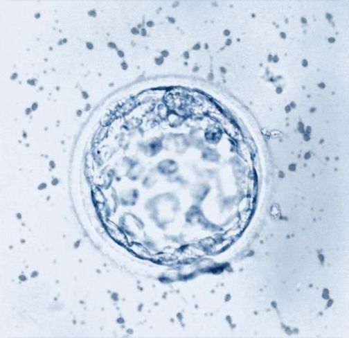 Five-day old blastocyst.
