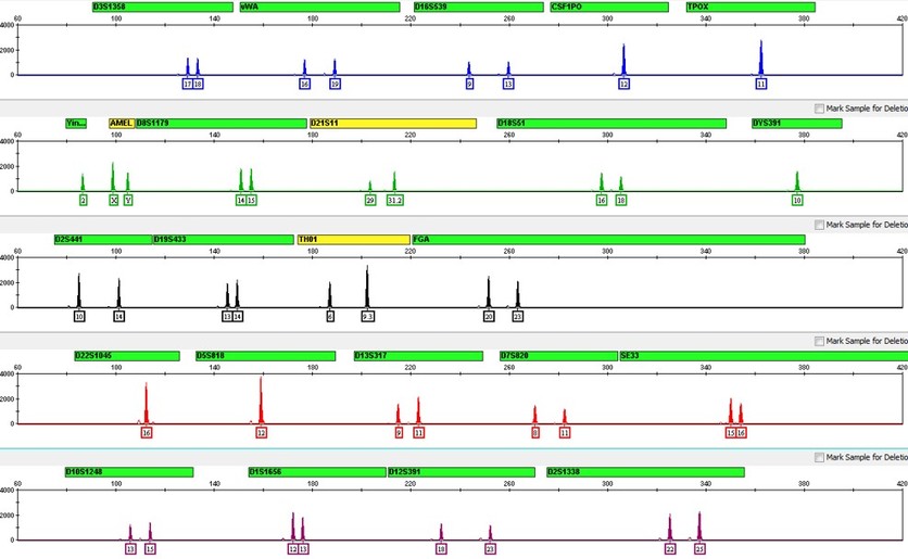 An example of a DNA profile.