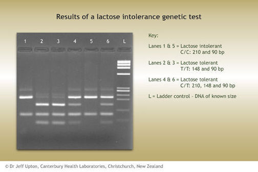 a genetic test for lactose intolerance