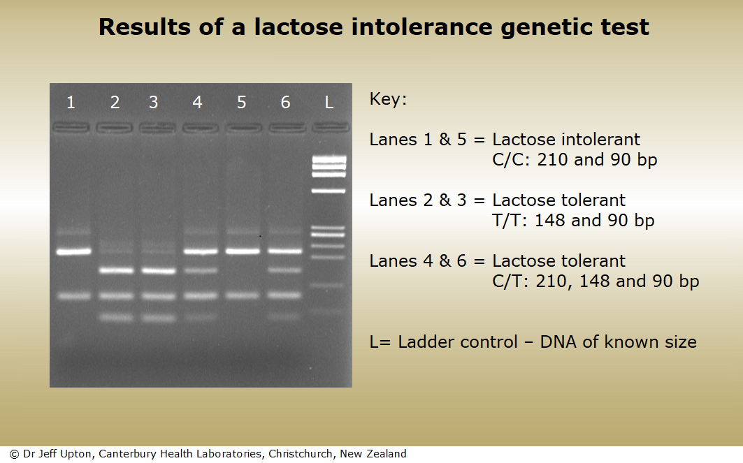 Genetic test for lactose intolerance uses DNA from blood samples