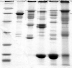 Gel electrophoresis — Science Learning Hub