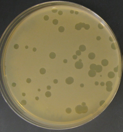 Acne bacteria with P. acnes phages in a petri dish
