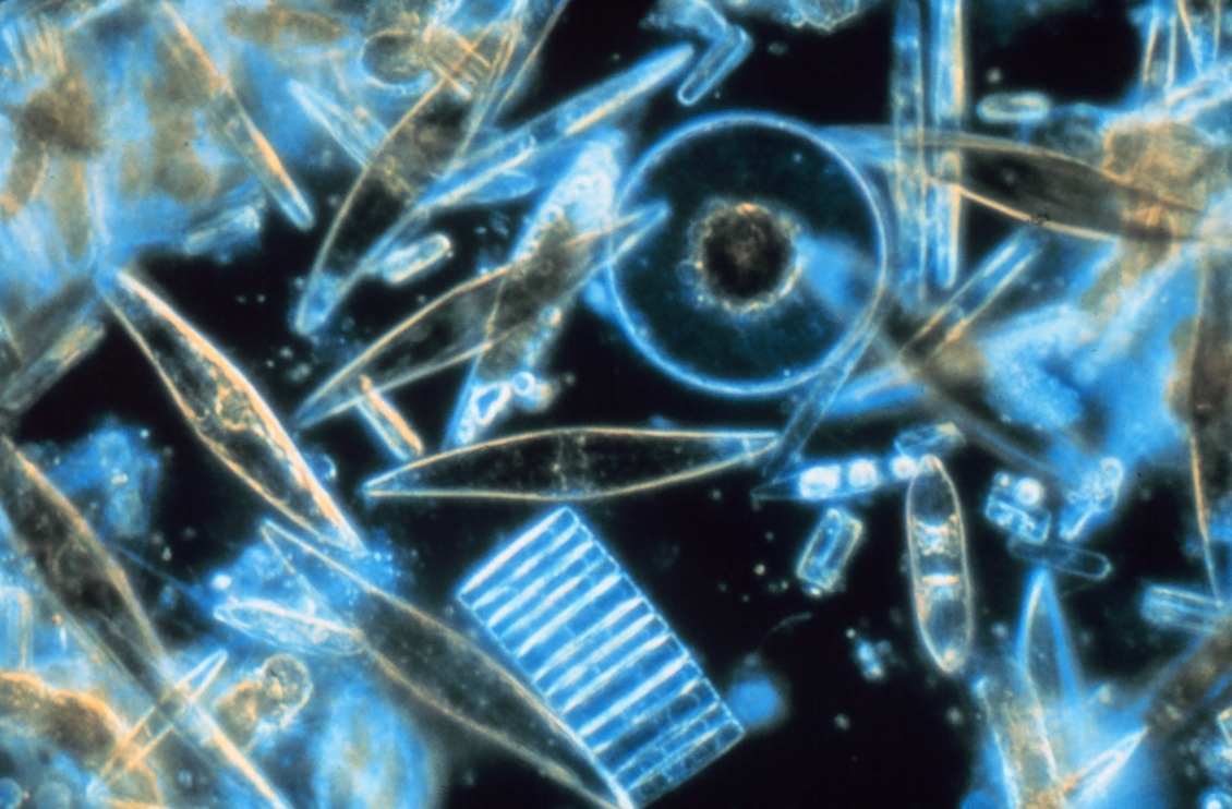 Diatoms (a common type of phytoplankton) under the microscope.