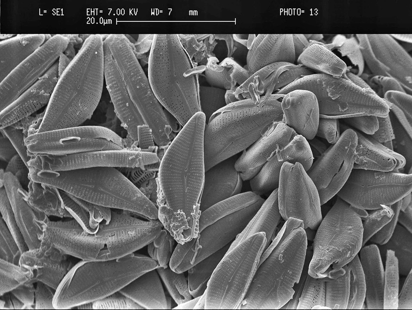 Scanning electron microscope of fossil diatoms from Foulden Maar