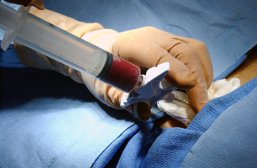 bone marrow transplant procedure