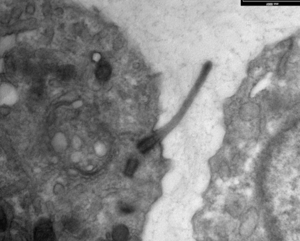Primary cilium under a transmission electron microscope (TEM)