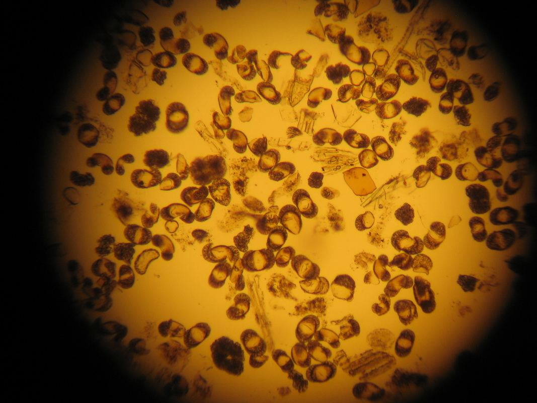 graphic organizer and writing assignment radiocarbon dating Pollen concentrated for radiocarbon dating.