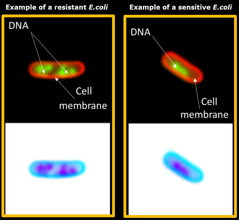 2 examples of E. coli resistant or sensitive to ciprofloxacin