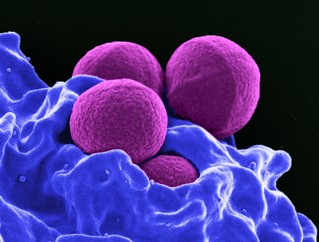 Four MRSA bacteria being engulfed by a white blood cell.