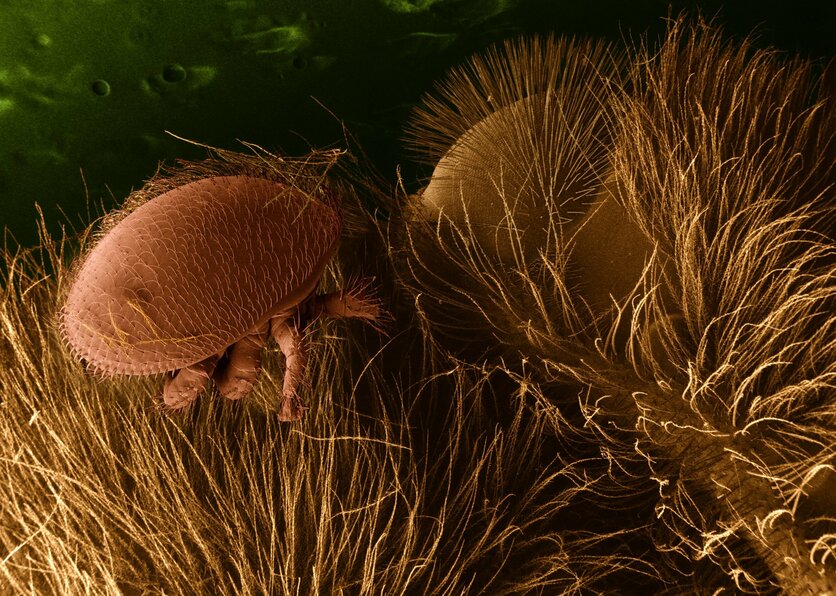 Oval brown Varro mite surrounded by magnified bee hairs.